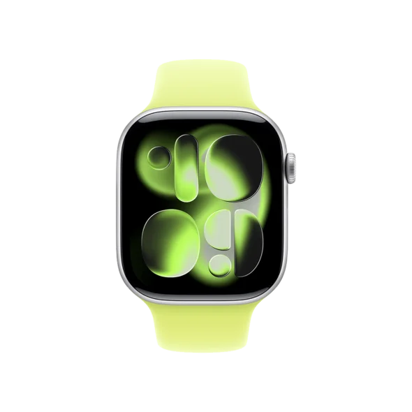 Ремінець Apple Neon Yellow Sport Band S/M для Watch 38/40/41/42mm (MFFT4, MFGC4) | магазин Apple Grokholsky.com — Фото 2
